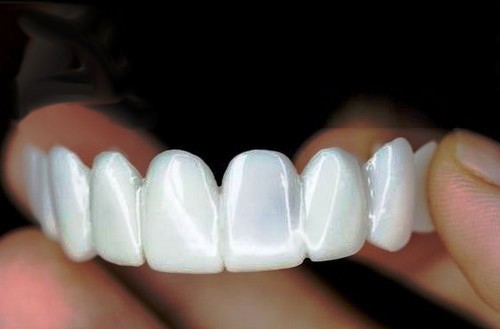 برای تهیه اسنپ اسمایل به کدام دندانسازی برم 