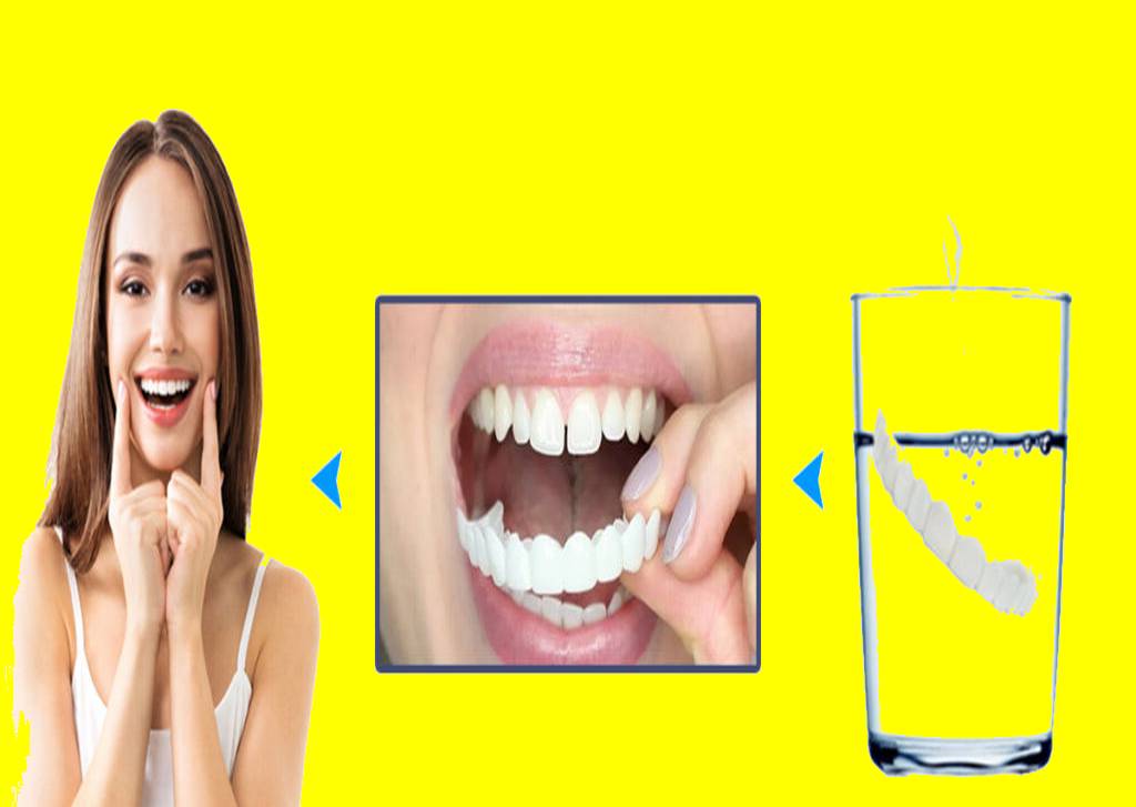 ایا لمینت متحرک دندان برای کسانی که هیچ دندانی ندارند مناسب است ؟
