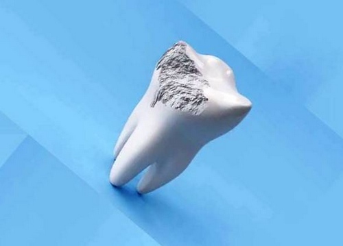 چه چیزی باعث فرسایش مینای دندان خواهد شد 