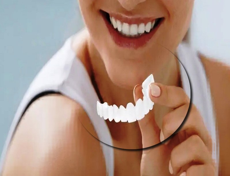 ایا کامپوزیت موقت می تواند باعث پوسیدگی دندان شود یا خیر 
