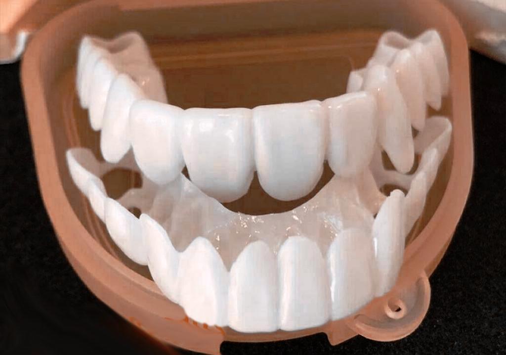 عمر اصلی لمینت متحرک دندان چند سال است 